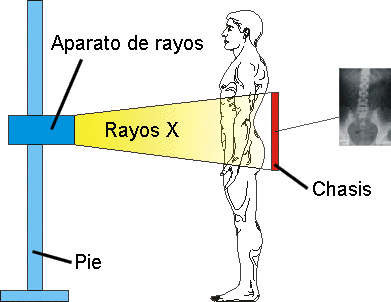Equipo de rayos X IngeniaMed